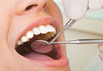 img-periodontologia